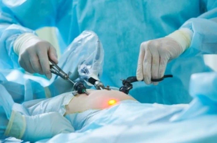 general-laparoscopic-Surgery (1)
